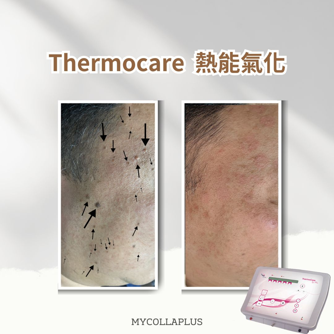 本頁圖片/檔案 - WhatsApp_Image_2025-04-13_at_5.09.23_PM_(2)